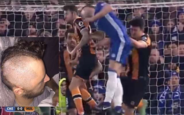 El volante inglés Ryan Mason anunció que, tras la fractura en el cráneo que sufrió en enero de 2017 en un partido contra el Chelsea, tiene que abandonar su carrera