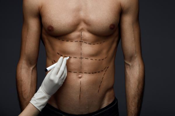Cuales son las cirugias abdominales