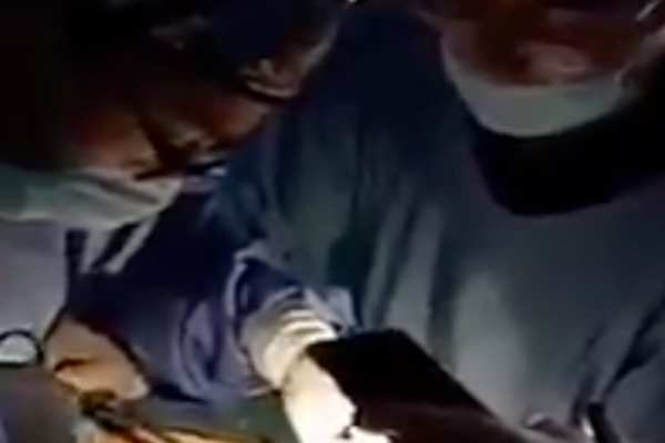 En las imágenes se puede observar a los especialistas en la cirugía mientras uno de los doctores sostiene el celular a pocos centímetros del paciente