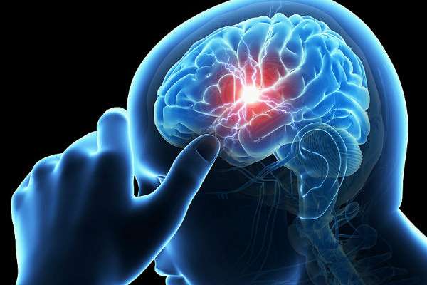 La demencia ha sido ligada a enfermedades como el Alzheimer. FOTO: ESPECIAL
