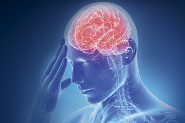 Infartos cerebrales: INFOGRAFÍA: PAUL D. PERDOMO
