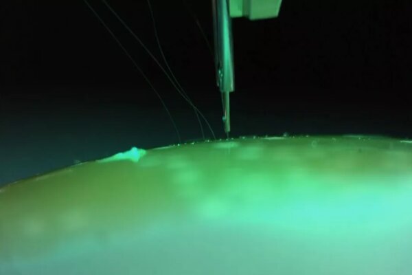 microelectrodos
