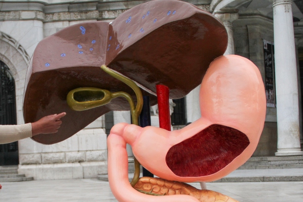 Muerte por cirrosis