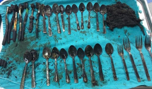 Hallan_tenedores_cucharas_estómago