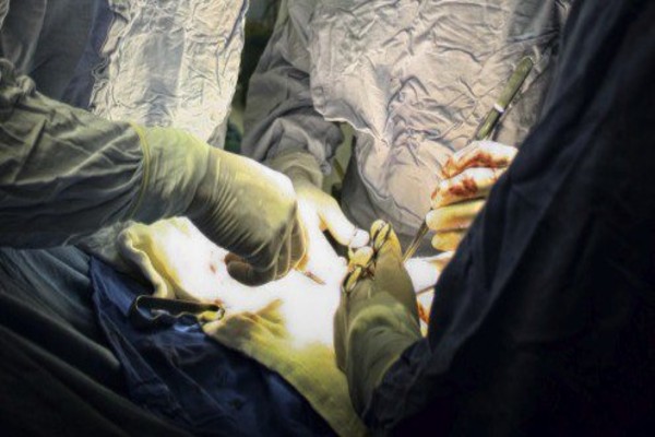 imss_organos_donacion_nuevo_leon
