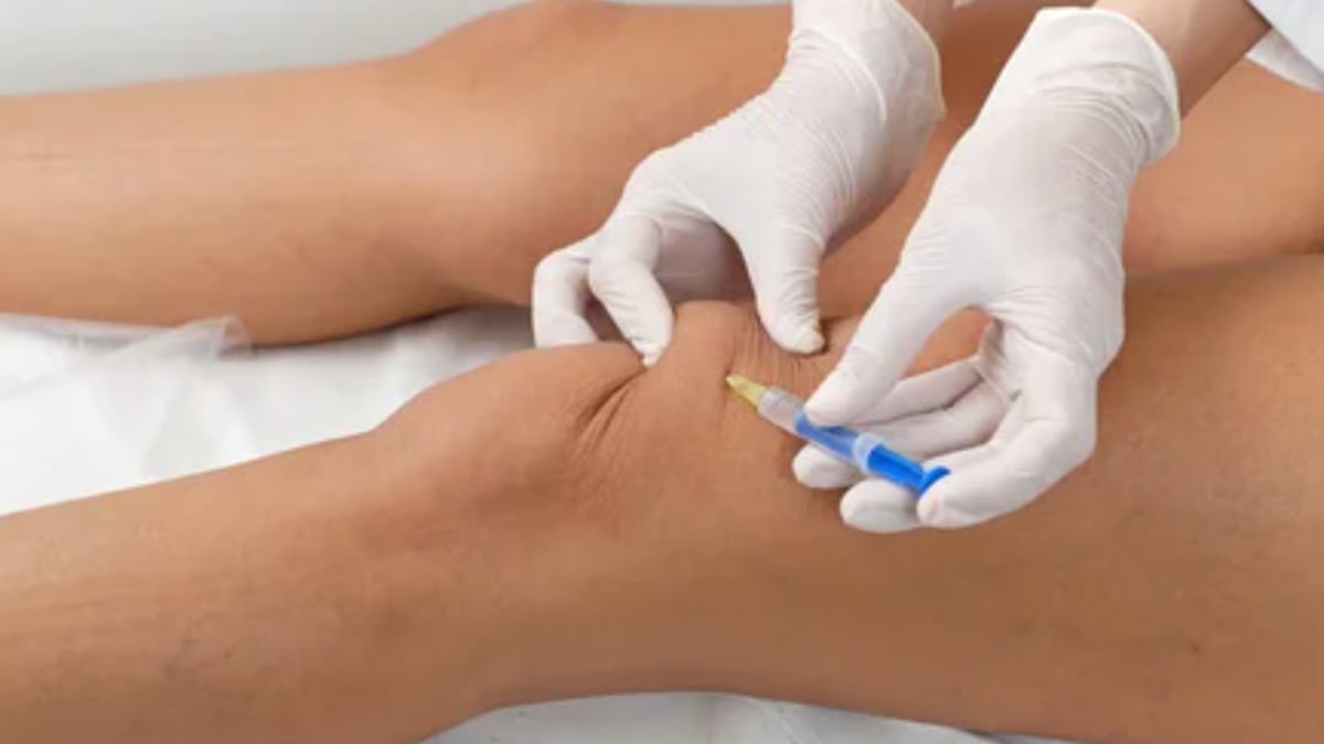 líquido sinovial rodilla tratamiento