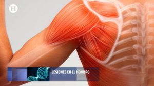 ¡Cuidado al cargar cosas pesadas! podrías ocasionarte una lesión de hombro