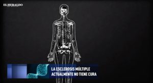 El cerebro y la esclerosis múltiple