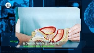 Cáncer, Próstata, Hombres,Detección, prevención, Raymundo Bernal García, Mariano Riva Palacio, El Heraldo TV,