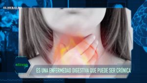 ¡Cuidate del reflujo! te podría ocasionar una enfermedad crónica