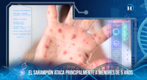 Aumento en casos de sarampión se debe a bajo índice de vacunación